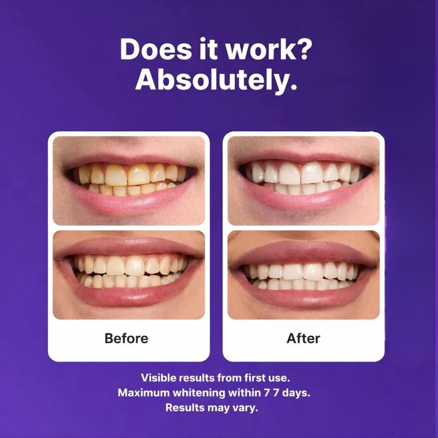 Luvund Purple Teeth Whitening Strips™