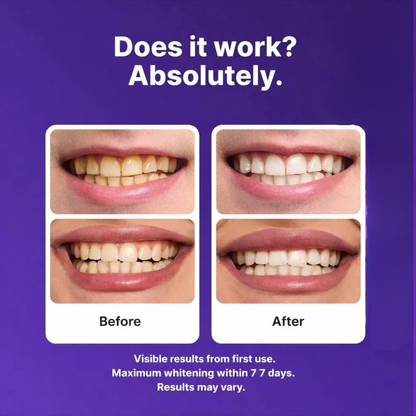 Luvund Purple Teeth Whitening Strips™